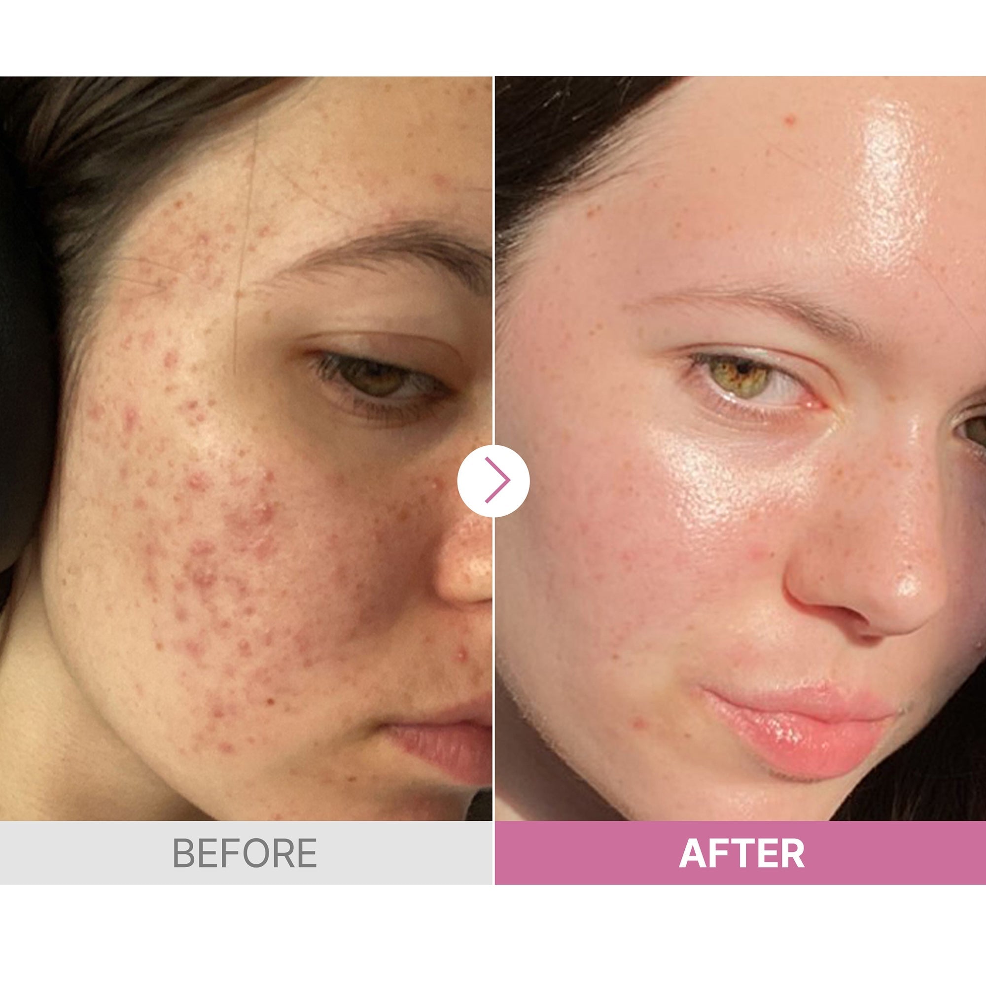 The Niacinamide 15 Serum 20ml