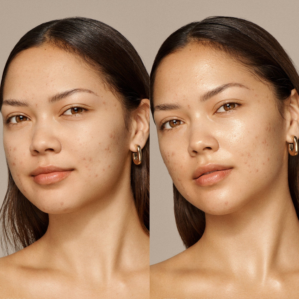 Skin Nova 10ml by VIEVE