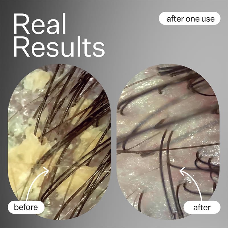 Cold Processed Scalp Detox Oil by Act+Acre