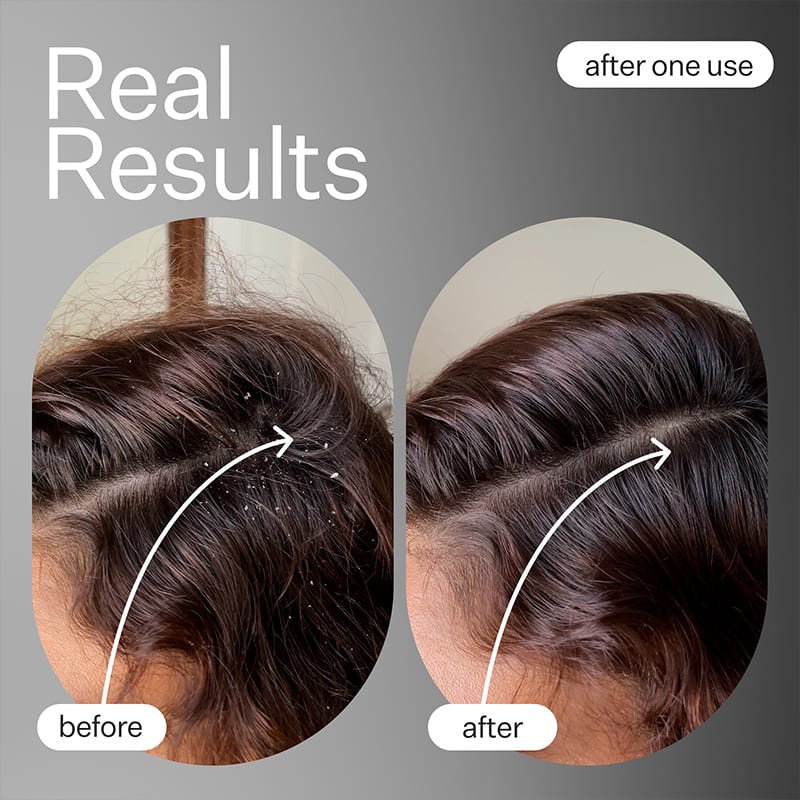 Cold Processed Scalp Detox Oil by Act+Acre