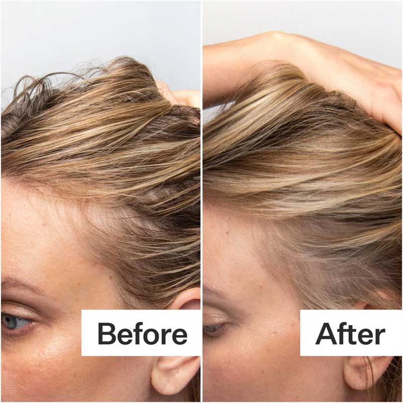 Oily Scalp System by Act+Acre