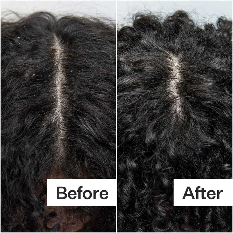 Scalp Build-Up System by Act+Acre