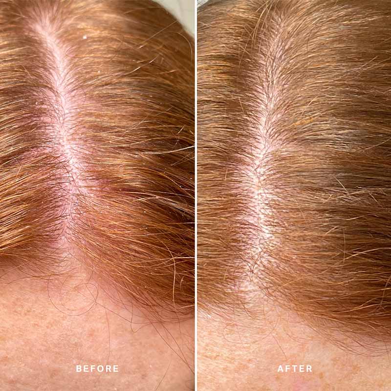 Healthy Scalp Exfoliating Treatment With Australian Desert Lime by Alpha-H