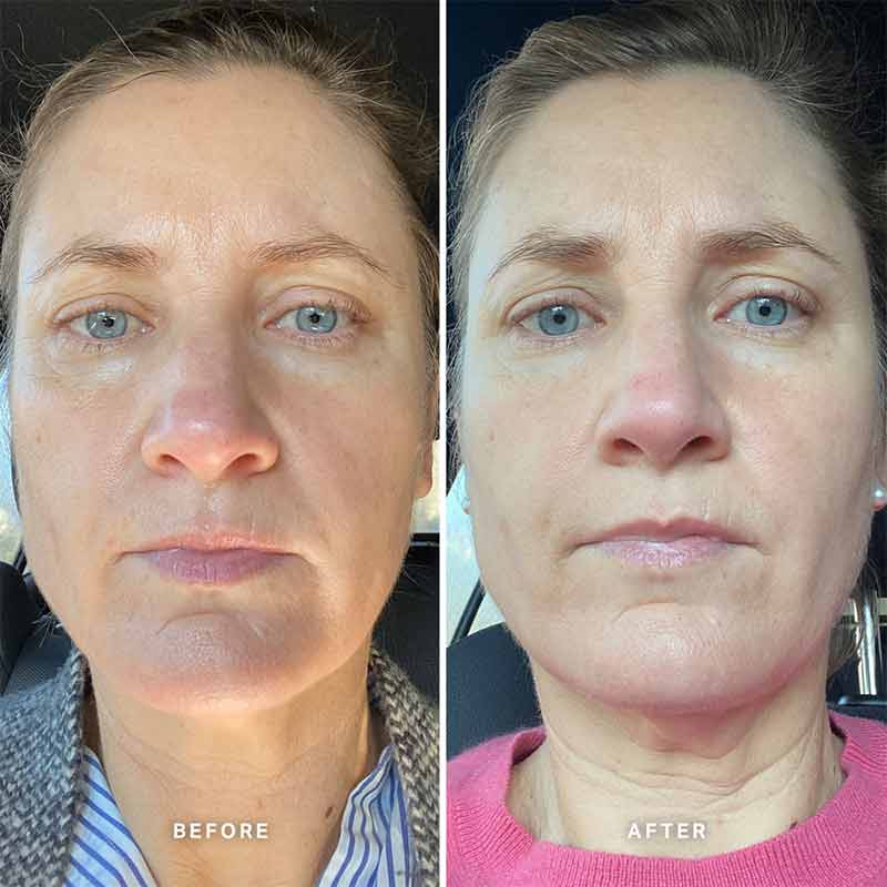 Vitamin A Serum with 0.5% Retinol by Alpha-H