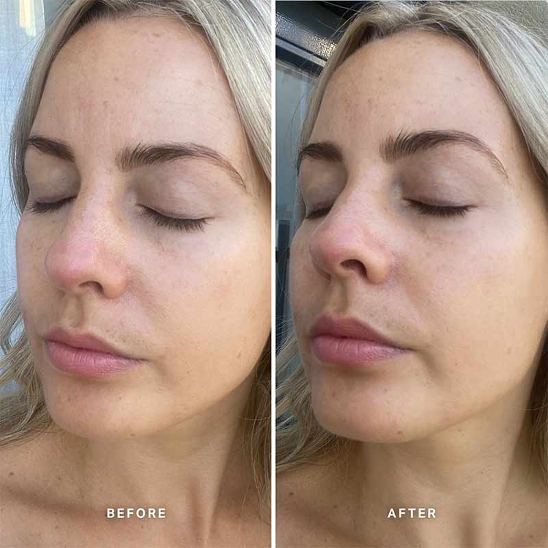 Vitamin E Serum With 1% Ceramide Complex