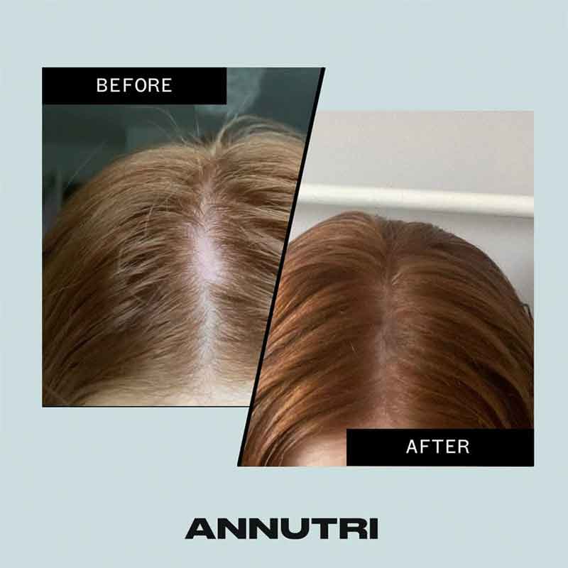 Grow It Hair Growth Supplement 6 Month Supply by Annutri