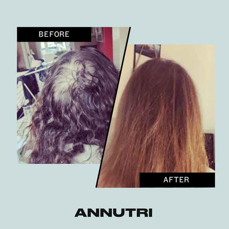 Grow It Hair Growth Supplement 6 Month Supply by Annutri