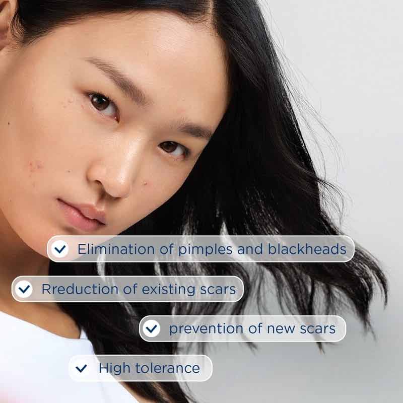 Sebium Kerato+ Anti-Blemish High Tolerance Gel-Cream