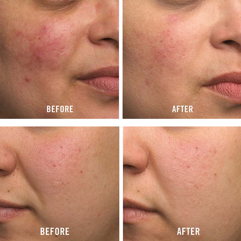 Ultra Repair Cream 230g