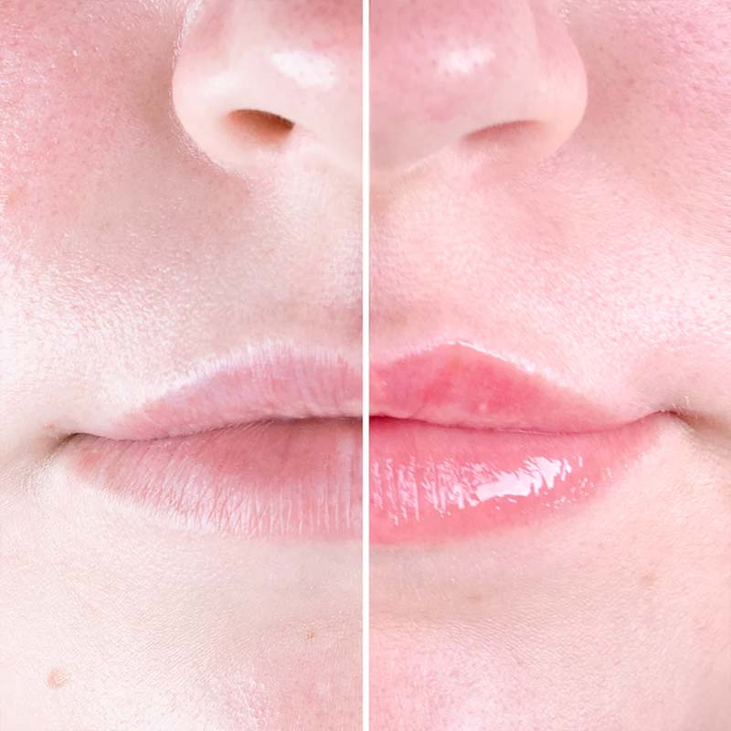 Chili Lips Lip Plumper