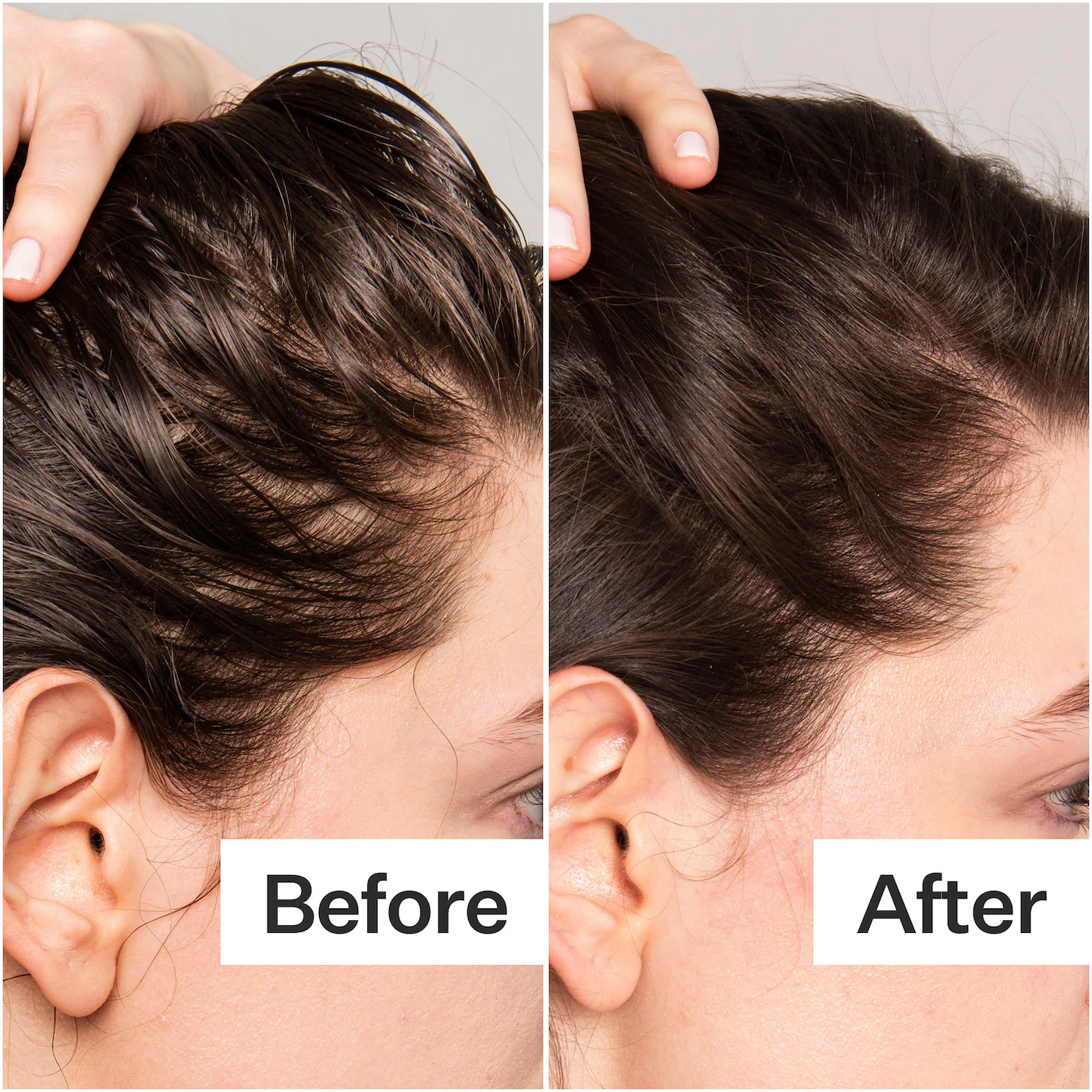 Act+Acre Salicylic Acid Scalp Renew Exfoliator For Oily + Flakey Scalp