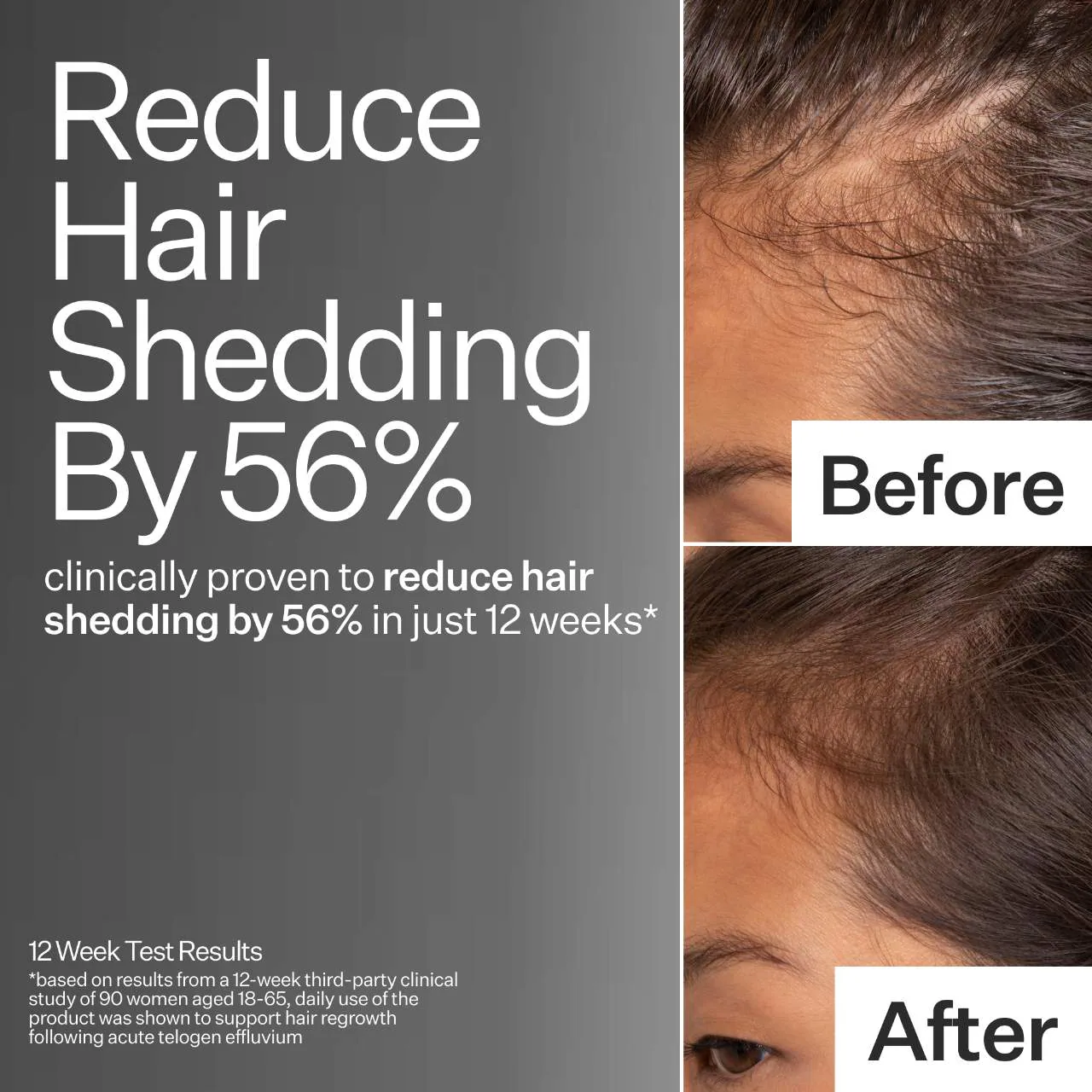 Act+Acre 2% Stem Cell H-2 Grow Complex ™ Scalp Serum For Thicker-Looking Hair