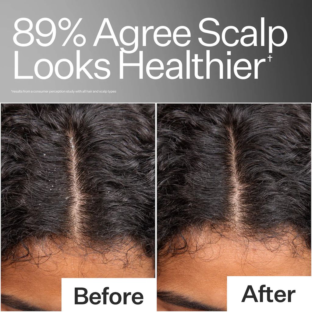 Act+Acre Scalp Relief System for Dandruff + Psoriasis + Eczema Gift Set