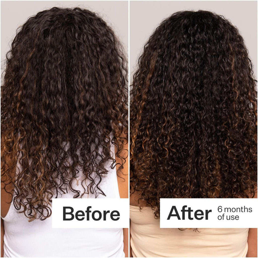 Act+Acre 2% Stem Cell H-2 Grow Complex ™ Scalp Serum For Thicker-Looking Hair