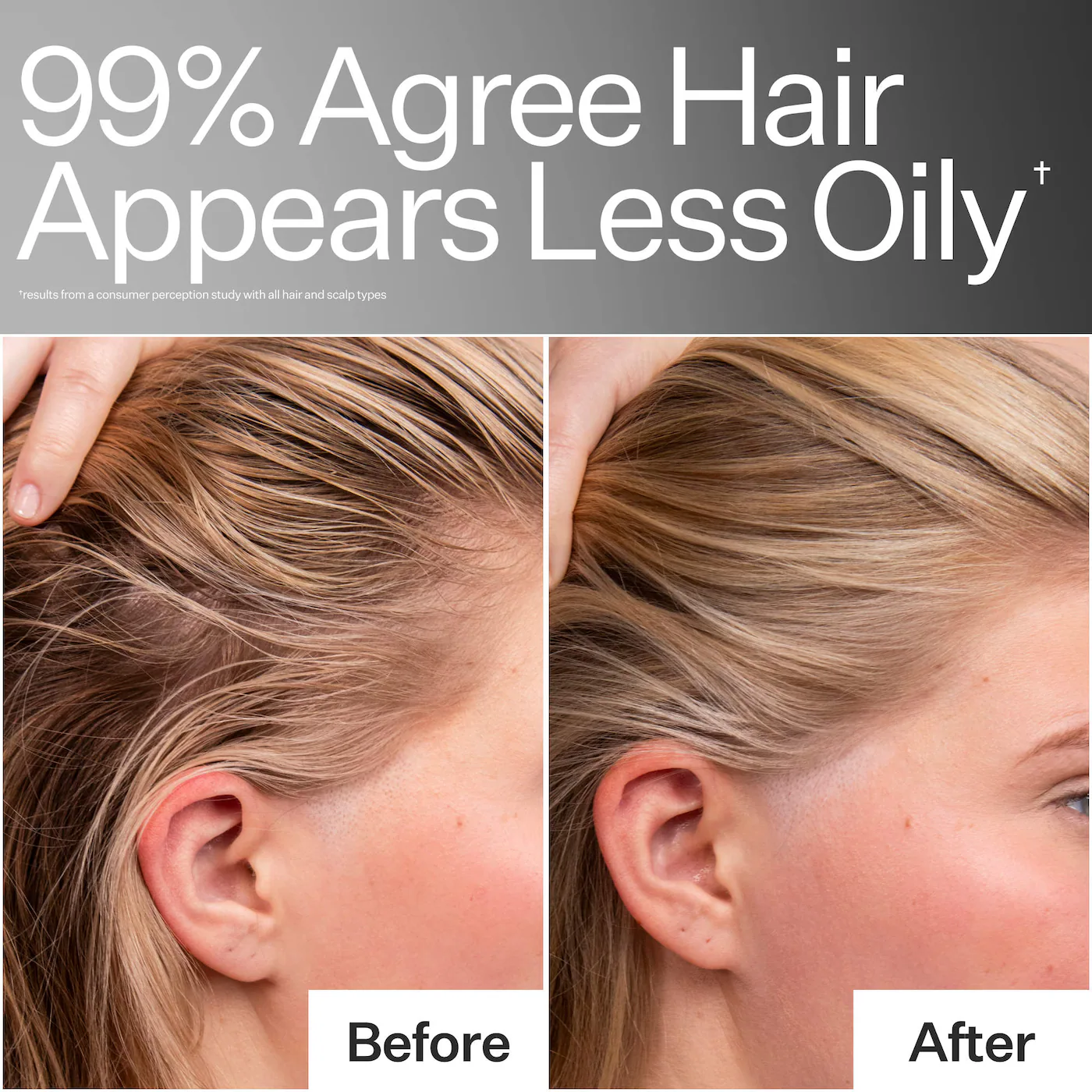 4% Niacinamide Scalp Serum For Oily Scalp + Hair