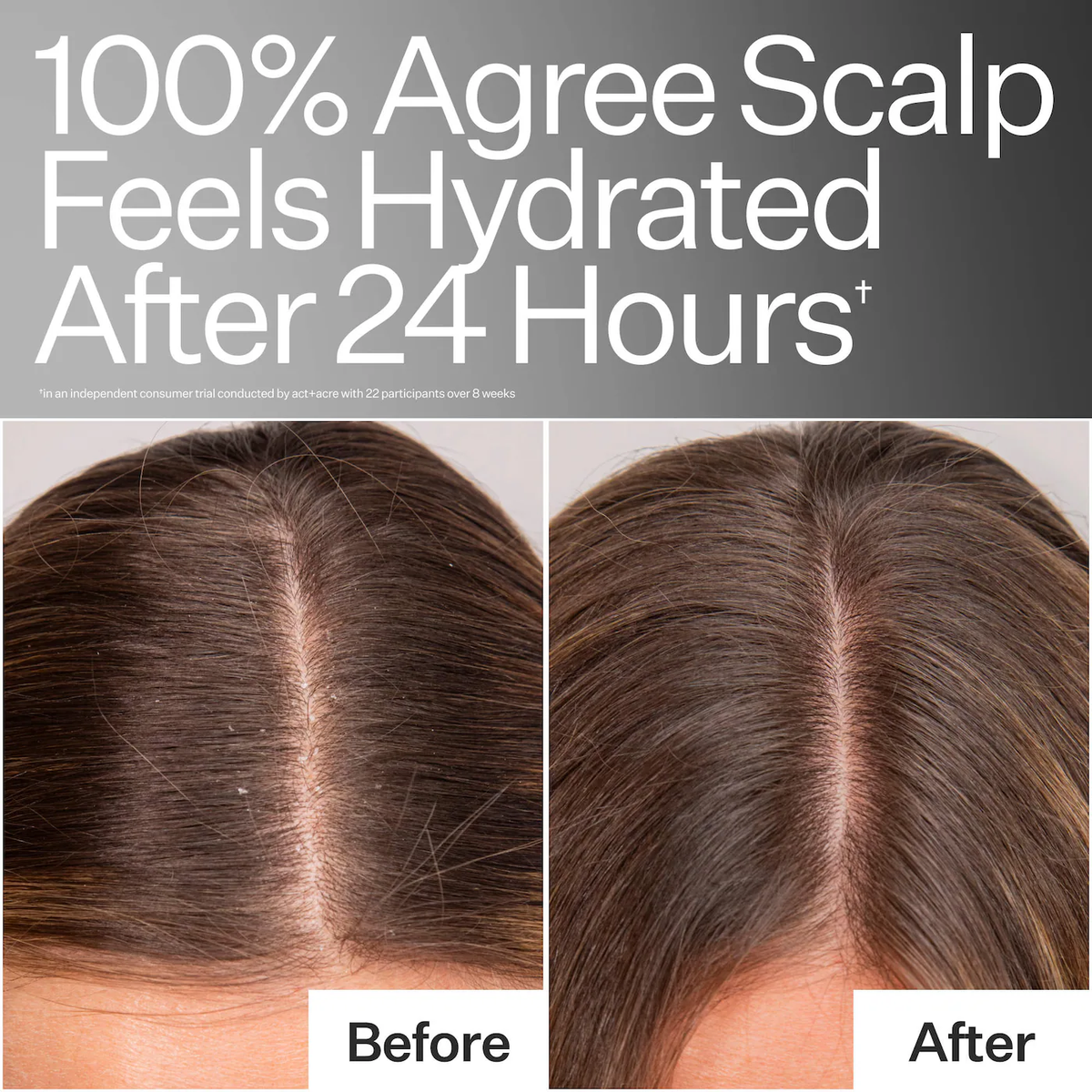 Act+Acre Daily Hydro™ Scalp Serum with Hyaluronic Acid for Dry Scalp
