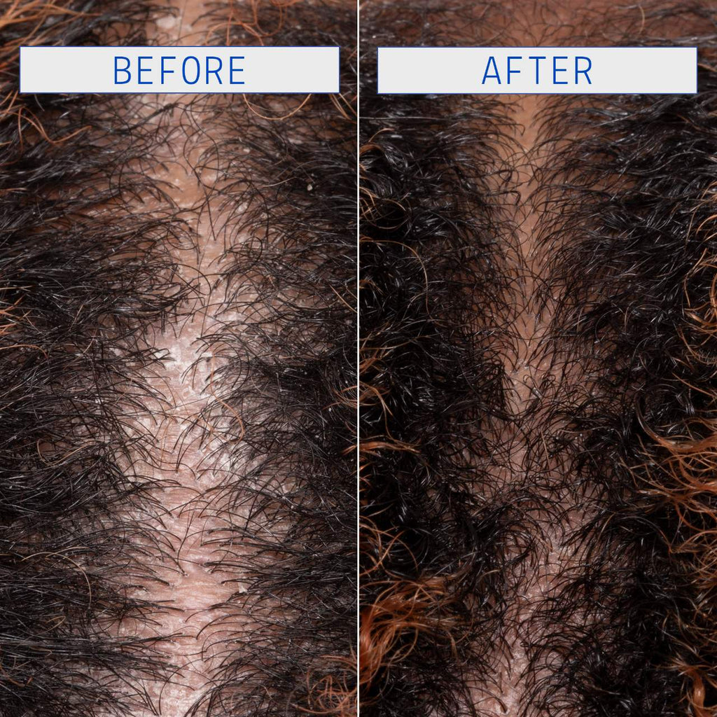 AAVRANI Jelly Clarifying Detox Shampoo for Scalp & Hair