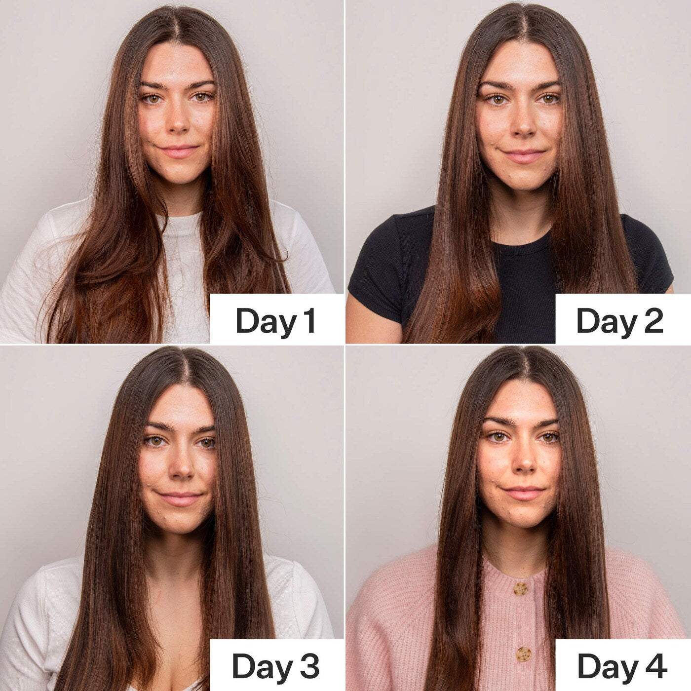 4% Niacinamide Scalp Serum For Oily Scalp + Hair