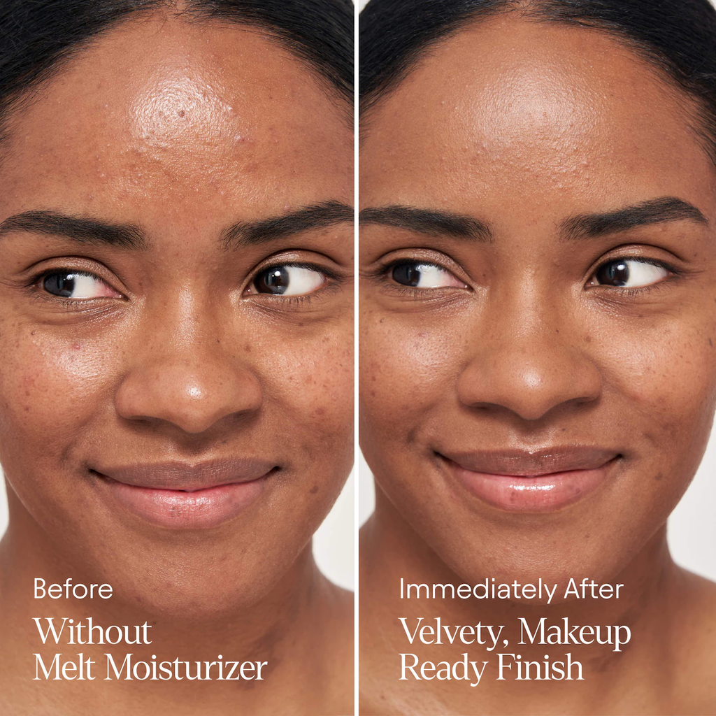 ALPYN Melt Moisturizer for Firming, Plumping & Brightening