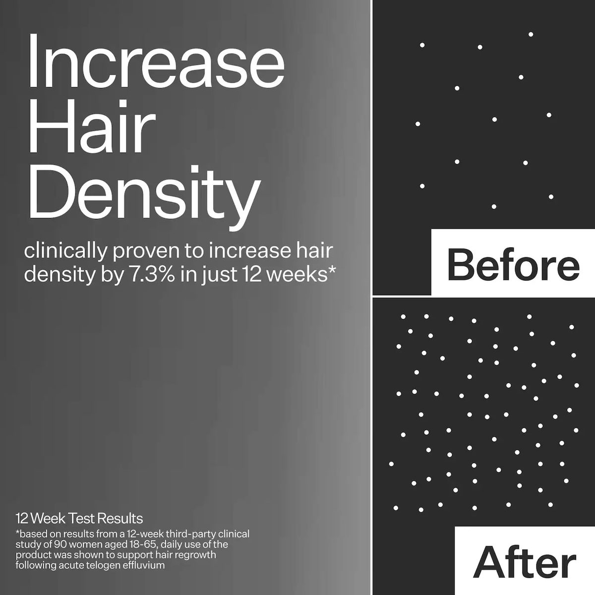 Act+Acre 3% Stem Cell Peptide Hair + Scalp Treatment For Severe Hair Thinning
