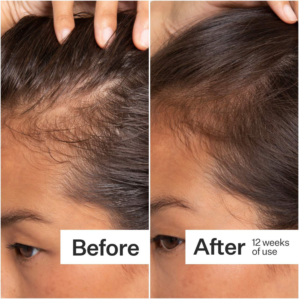 Act+Acre 2% Stem Cell H-2 Grow Complex ™ Scalp Serum For Thicker-Looking Hair