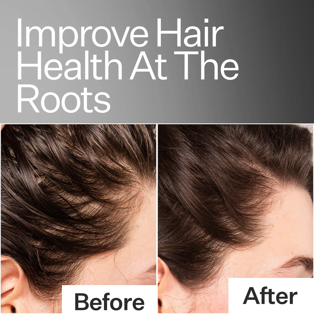 Act+Acre Scalp Relief System for Dandruff + Psoriasis + Eczema Gift Set