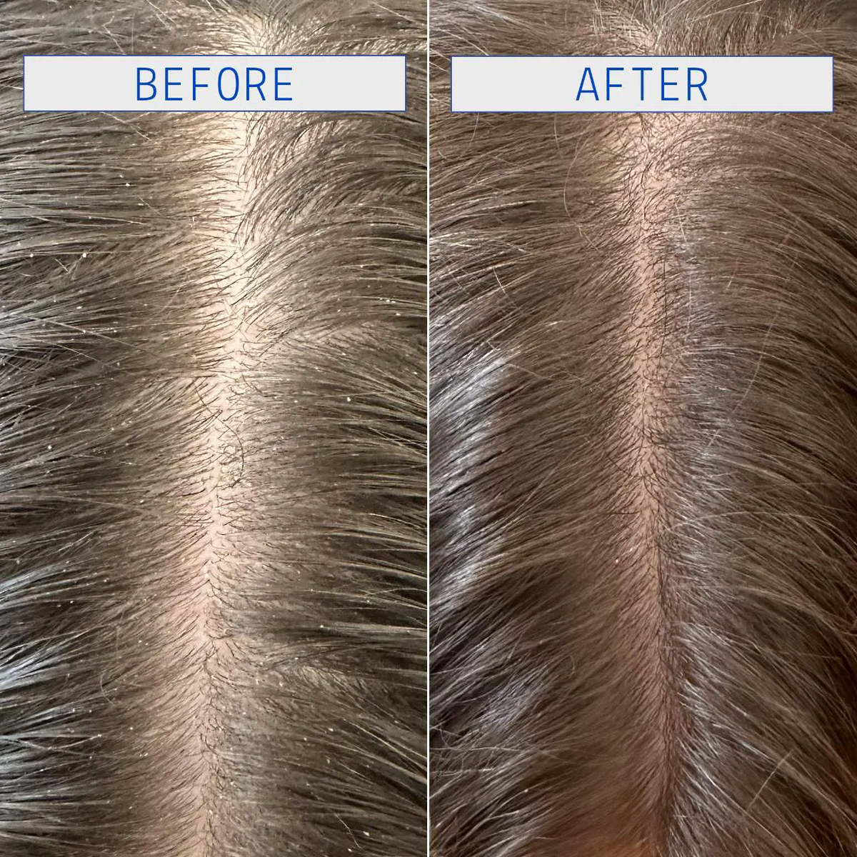 AAVRANI Jelly Clarifying Detox Shampoo for Scalp & Hair