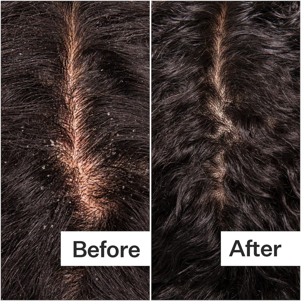 Act+Acre Microbiome Cooling Scalp Serum For Dry Itchy Scalp + Loose Flakes