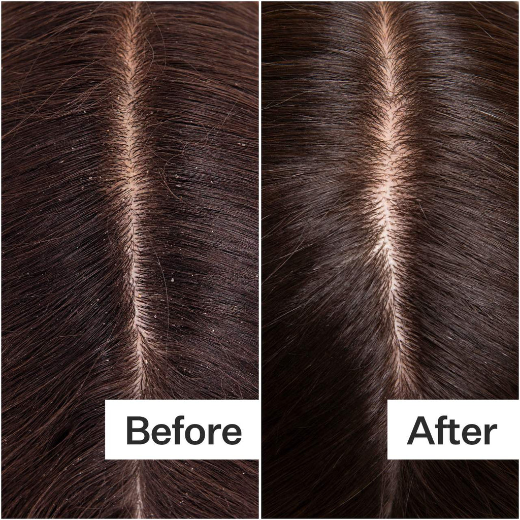 Act+Acre Cold Processed Balancing Shampoo For All Scalp + Hair Types