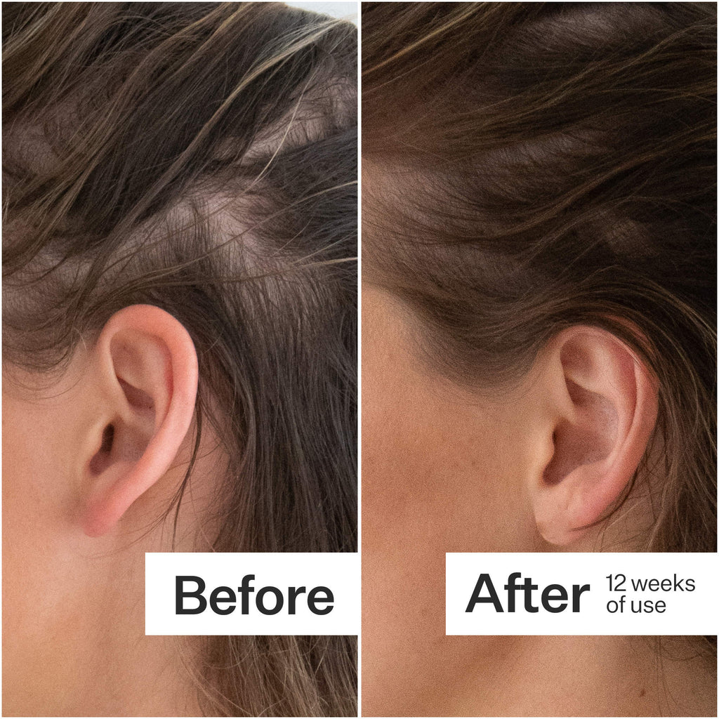 Act+Acre Thick + Full Hair Capsules for Fuller-Looking Hair