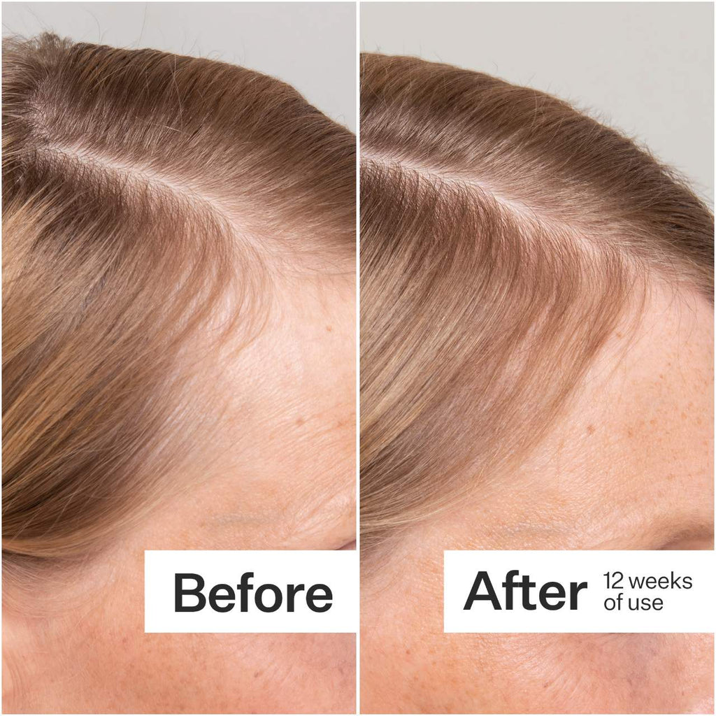 Act+Acre 2% Stem Cell H-2 Grow Complex ™ Scalp Serum For Thicker-Looking Hair