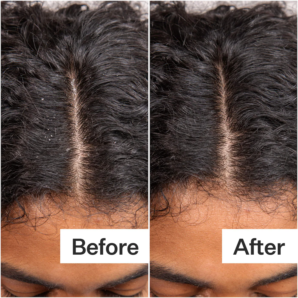 Act+Acre Daily Hydro™ Scalp Serum with Hyaluronic Acid for Dry Scalp