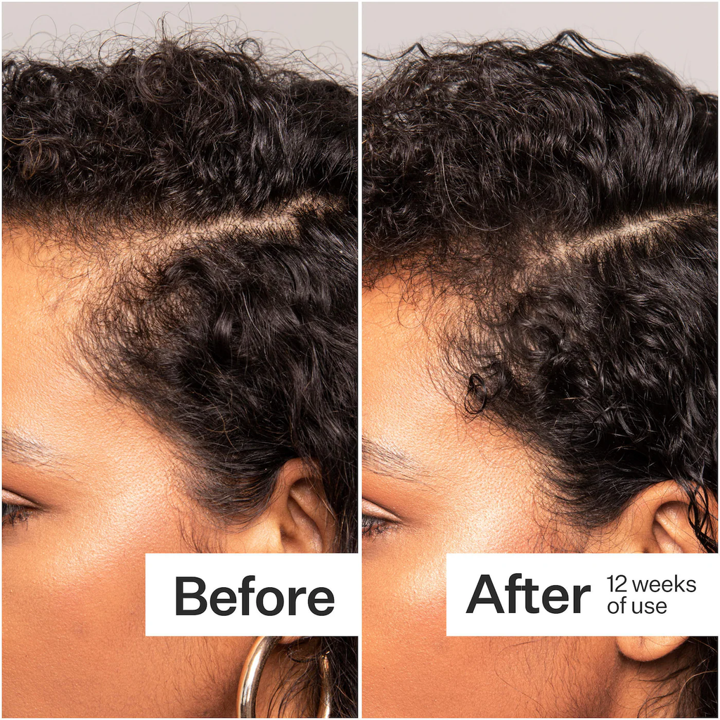 Act+Acre Thick + Full Hair Capsules for Fuller-Looking Hair