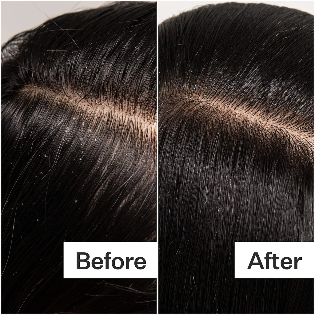 Act+Acre Cold Processed Scalp Detox Oil For Dry Scalp