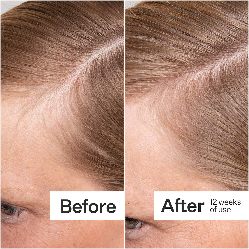 Act+Acre Thick + Full Hair Capsules for Fuller-Looking Hair