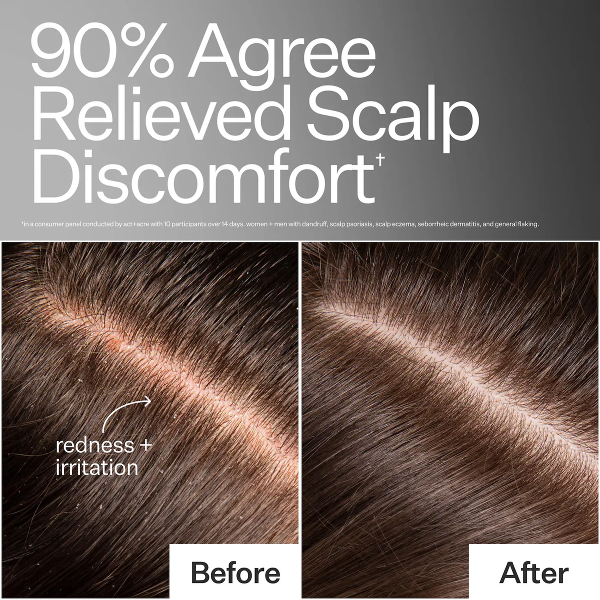 Act+Acre Microbiome Cooling Scalp Serum For Dry Itchy Scalp + Loose Flakes