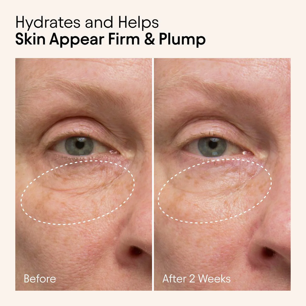 ALPYN Hydrating Firming Serum with Niacinamide & Nettle