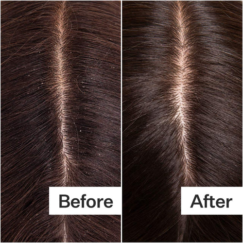 Act+Acre Cold Processed Balancing Shampoo For All Scalp + Hair Types