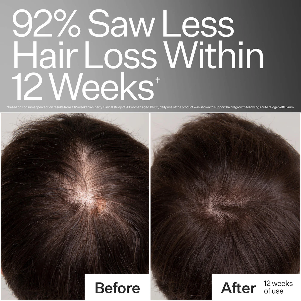 Act+Acre 3% Stem Cell Peptide Hair + Scalp Treatment For Severe Hair Thinning