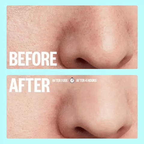 Peace Out Pores 4 Nose Strips and 4 Pore Strips