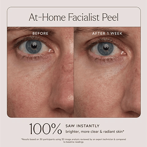 True Botanicals At-Home Facialist Peel 30ml