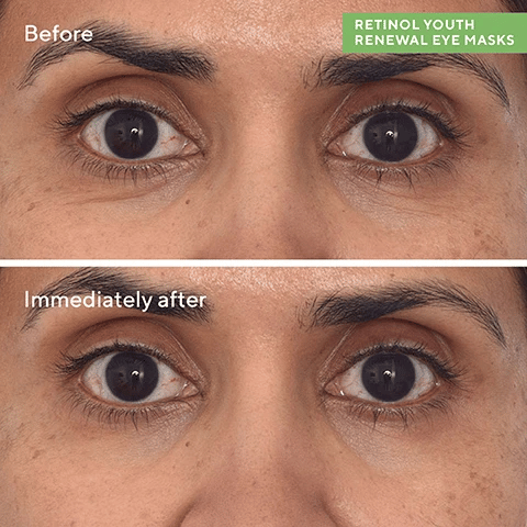Murad Retinol Youth Renewal Eye Masks (5 Pack)