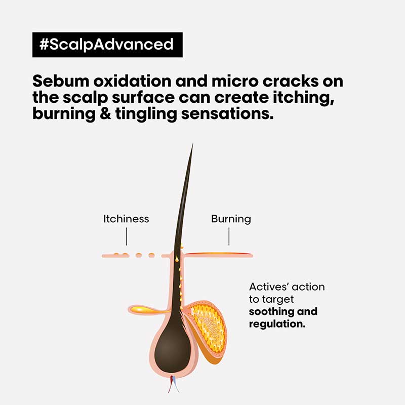 Scalp Advanced Anti-Discomfort Hair Treatment by L'Oréal Professionnel