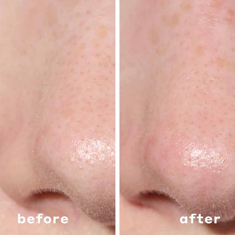 2-in-1 Deep Cleansing Pore Strip by Mario Badescu