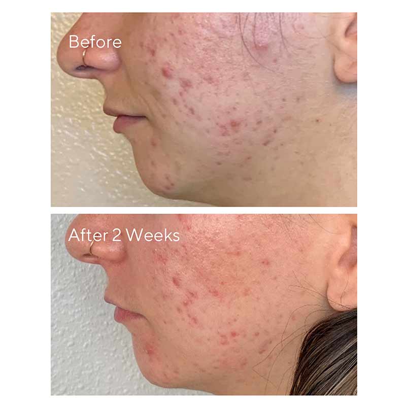 Daily Clarifying Peel