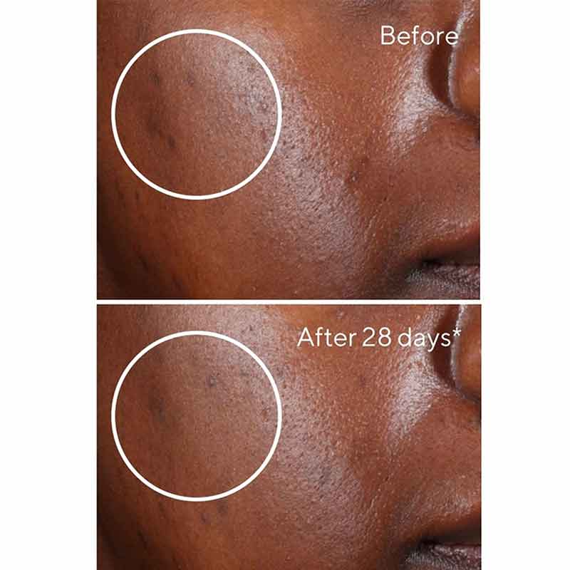 Environmental Shield Rapid Dark Spot Correcting Serum