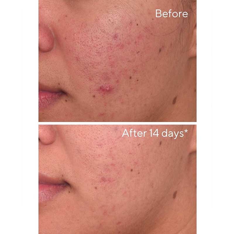 Environmental Shield Rapid Dark Spot Correcting Serum