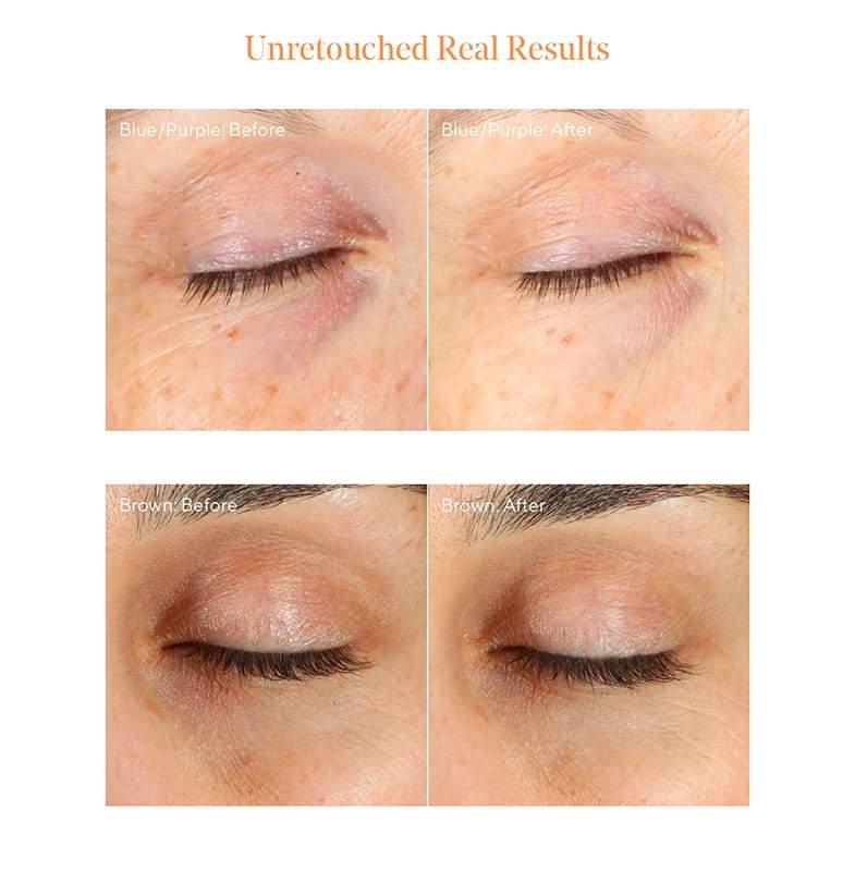 Vita-C Eyes Dark Circle Corrector by Murad