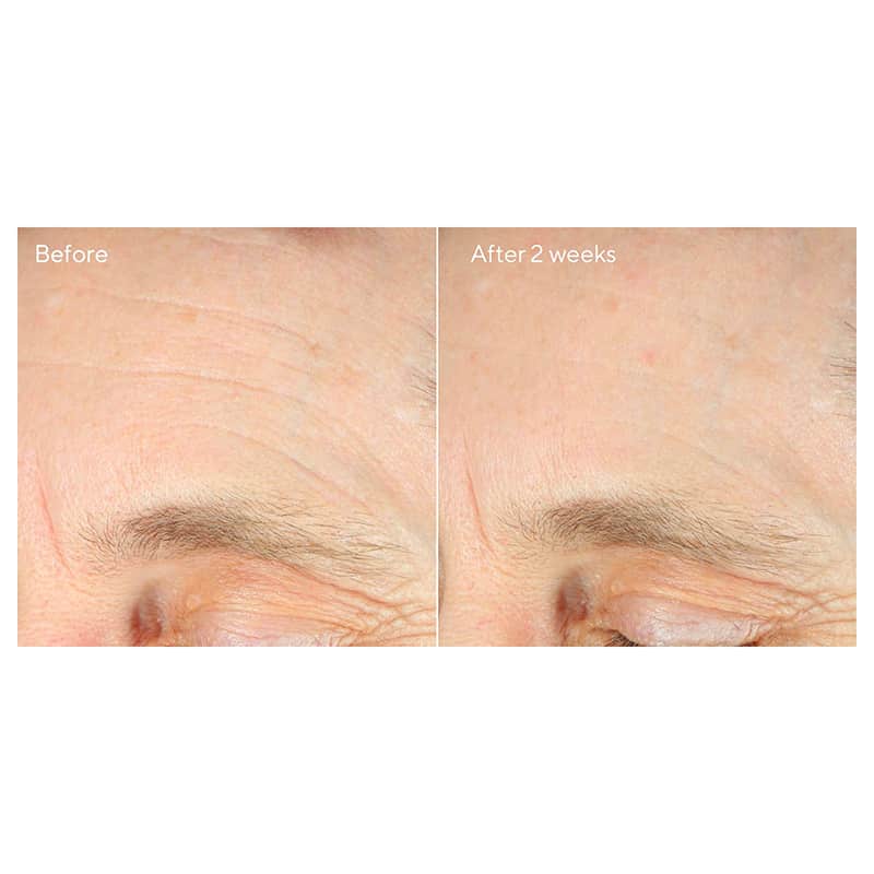Intense Recovery Cream by Murad