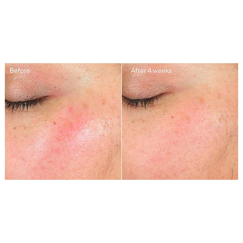 Intense Recovery Cream by Murad